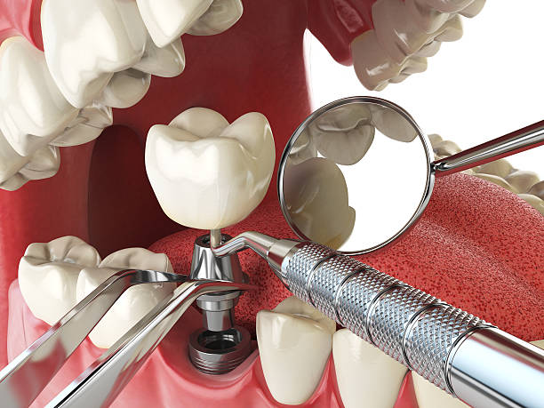 Best Urgent Tooth Repair  in Villa Park, CA